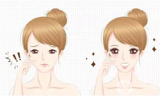 割雙眼皮后癢是因為啥 雙眼皮癢正常嗎