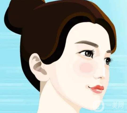 假體下巴多久恢復(fù)？恢復(fù)過(guò)程怎樣的？