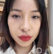 眼袋的形成讓我脾氣變得暴躁起來，父母說我是因為通宵或者是愛哭才發(fā)生的