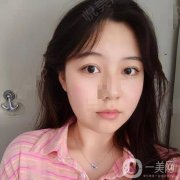 大家都說臉上有疤的人，小時(shí)候一定會(huì)皮，我爸媽都管不住我