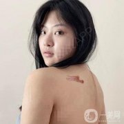 對(duì)于我們這種身上有疤的人來說，每一塊地方都是一個(gè)特別痛苦的回憶