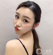 除皺:面診的時(shí)候，醫(yī)生也是的專業(yè)，說(shuō)出了本人的問(wèn)題，結(jié)合問(wèn)題做出了方案