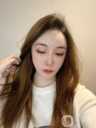 注射完了玻尿酸以后，我的臉有一些腫脹感，但不是很嚴(yán)重，當(dāng)時(shí)我的臉上還貼