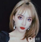 做熱瑪吉之前，我臉上有很多痘印，鼻翼兩邊的毛孔也特別的粗大