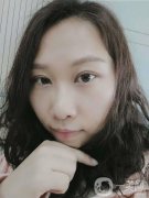 雙眼皮恢復這段時間我也收到了醫(yī)生很大的關(guān)懷，手術(shù)做的很快，大概不到兩個