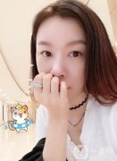 現(xiàn)在做完法令紋已經(jīng)有好幾年的時(shí)間了，依然會(huì)感覺很不錯(cuò)，是一個(gè)飽滿的狀態(tài)