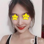 今天終于要完成我多年的夢想，去醫(yī)院做改臉型手術(shù)，心情好激動呀