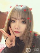 本來(lái)還是有一些單眼皮的，就是眼睛有點(diǎn)腫，看起來(lái)真的是特別的不好看