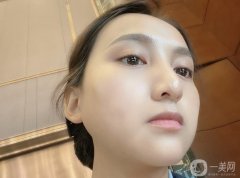 我一直對(duì)自己的臉很不滿意