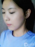 想要變得年輕就一定要好好的去呵護(hù)她