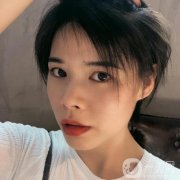 現(xiàn)在可以看到恢復(fù)得相當(dāng)不錯(cuò)，整個(gè)臉真的是越來越有立體感了