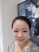 關(guān)于自己的玻尿酸注射手術(shù)過(guò)程，其實(shí)內(nèi)心里還是特別開(kāi)心