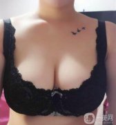 在嚴(yán)重的情況下對(duì)女性泌乳后期也有一定的影響，所以副乳切除是重要的