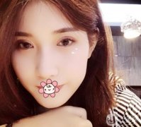 說(shuō)真的，單眼皮真的不好看，用了20多年，今年終于決定割雙眼皮了