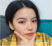 我終于下定決心做雙眼皮了，其實(shí)我想了很久，挑了很多醫(yī)院，看了很多案例，