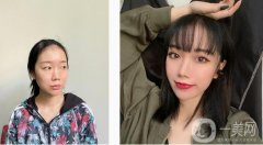 雖然我的眼睛在單眼皮里應(yīng)該比較大，雖然大，但是沒有層次感