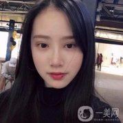 做雙眼皮手術(shù)前，我心里很掙扎，怕沒有做好反倒毀容了