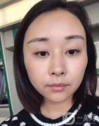 面診時醫(yī)生說面部凹陷相當(dāng)明顯，尤其是臉頰、太陽穴、額頭