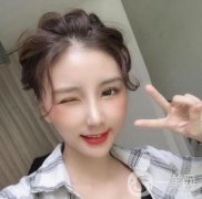 結(jié)合我的面部狀況和鼻子基礎(chǔ)，醫(yī)生為我設(shè)計了一系列直鼻類型