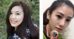 鼻子不立體不精致的體驗就是拍照無論從哪個角度看都不好看