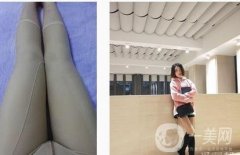 抽脂已經快四個月了，效果還是很棒的!以前不能穿的褲子現在可以輕松拿了