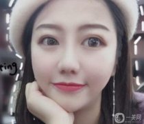 手術(shù)前鼻子不高，總覺得鼻子不好看