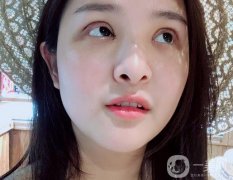 一定要特別注意雙眼皮的恢復期，說怎么剪雙眼皮的睫毛，怎么讓睫毛更長更密