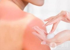 曬后修護(hù)攻略：應(yīng)對(duì)曬傷與暗沉，重拾肌膚光彩