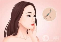 北大深圳醫(yī)院隆鼻案例分享！附崔永言、李天石醫(yī)生專業(yè)擅長一覽