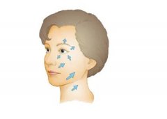 做一次熱瑪吉需要多少錢