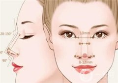 隆鼻的方法有哪些？