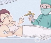 哪些人群應(yīng)避免注射溶脂針呢？