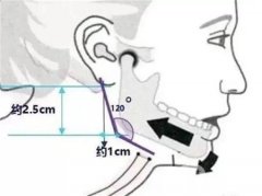 娜綺麗假體隆胸有哪些優(yōu)勢(shì)？