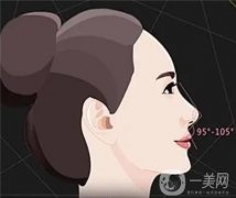 膨體進(jìn)口與國(guó)產(chǎn)的差異是什么