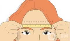 切眉手術(shù)的注意事項有哪些