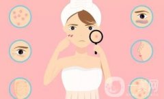 祛痘效果是否能夠永久保持