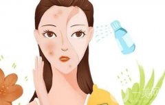 祛痘手術(shù)的價格受哪些因素的影響