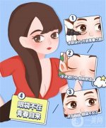 祛眼袋手術(shù)的費(fèi)及失敗的處理方法