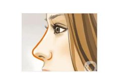 取出假體隆鼻后多久可以恢復(fù)