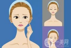 如何規(guī)避激光祛痘的風險