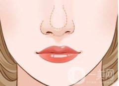 如何有效避免鼻整形修復帶來的二次傷害？