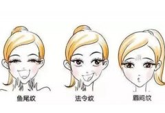 如何預防熱瑪吉導致的面部凹陷