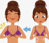 乳暈縮小手術(shù)的效果如何呢？