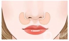 鼻頭縮小手術(shù)的風(fēng)險與副作用