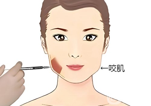 喬雅登雅致和極致區(qū)別在哪?信息對(duì)比一覽